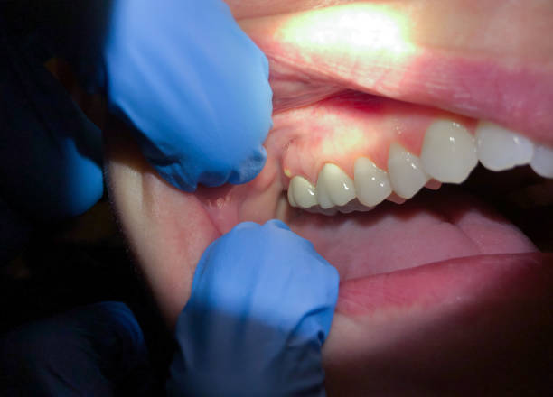 Best After-Hours Emergency Dentist in Glenn Dale, MD