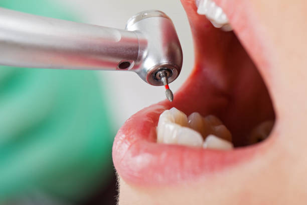 Best Emergency Broken Tooth Repair in Glenn Dale, MD